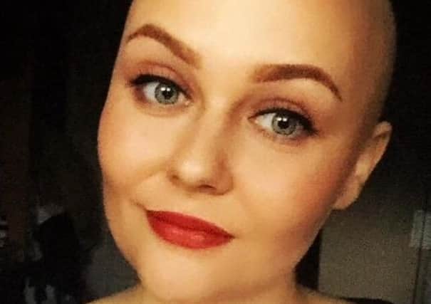 Megan's blog 'welcome to the bald side' was read by thousands of people